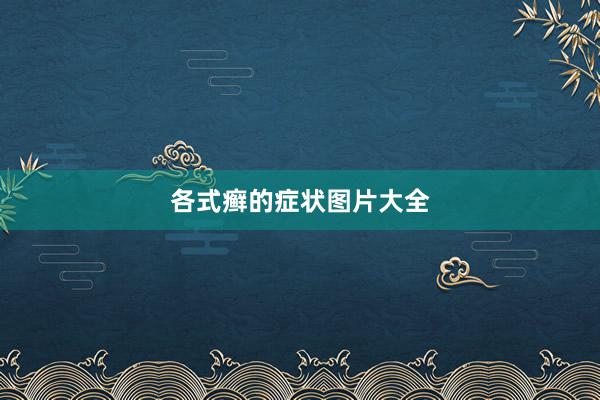 各式癣的症状图片大全